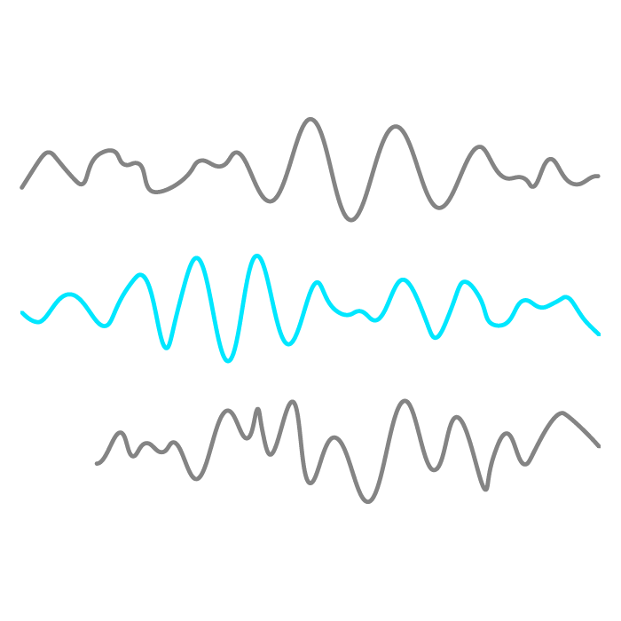 Illustration EEG-Daten